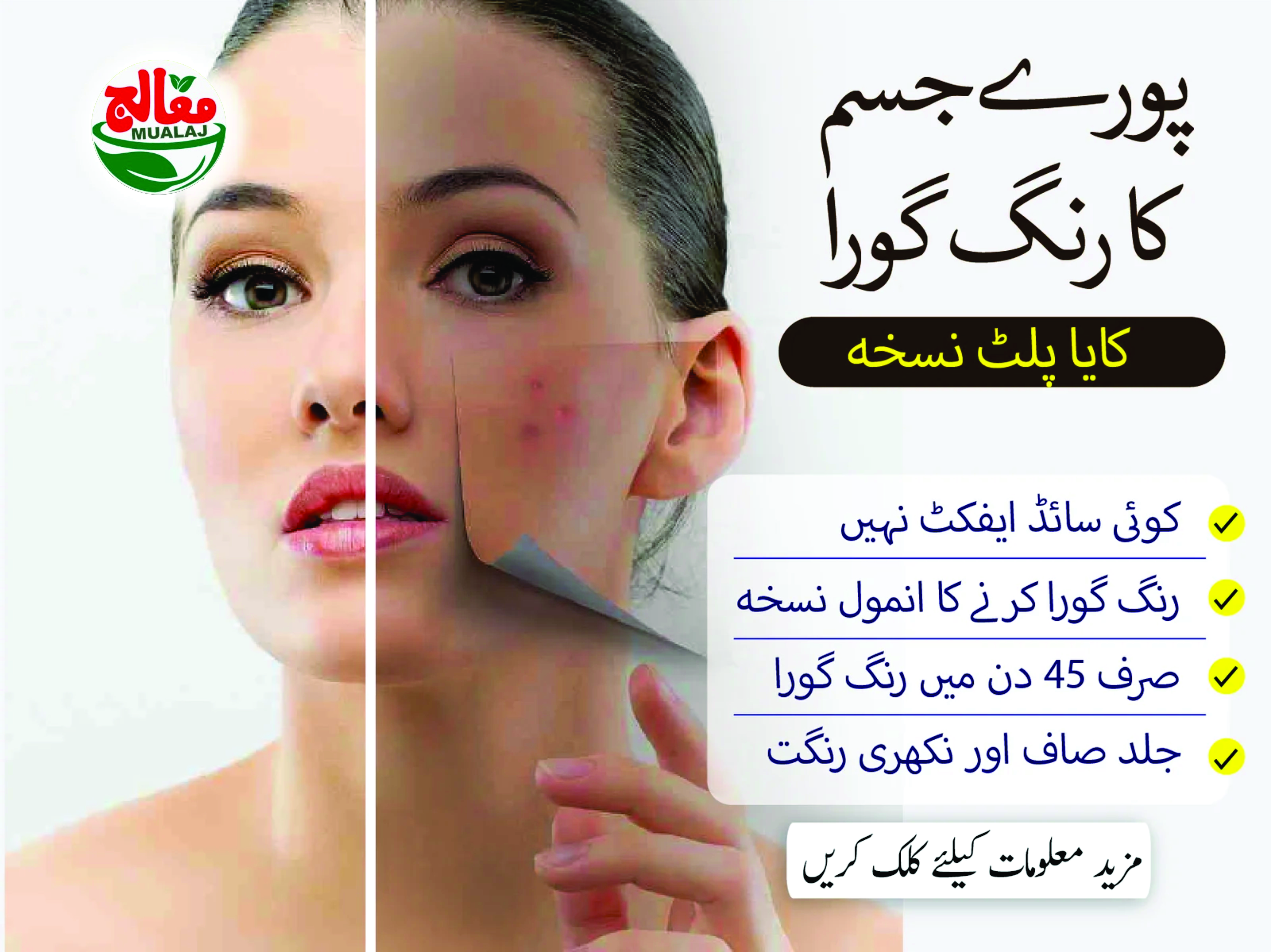 Skin Whitening 